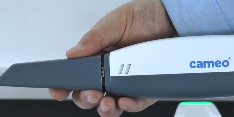 3D Intra-oral Scanner