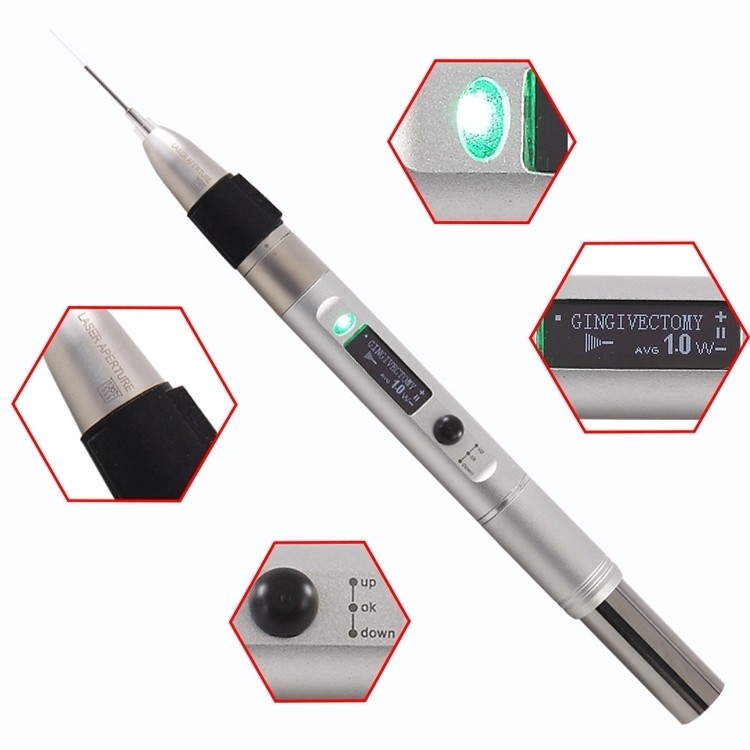 Dental Laser Soft Tissue Laser Treatment