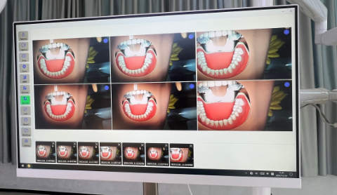 Dental Operating Lamp With Video Camera