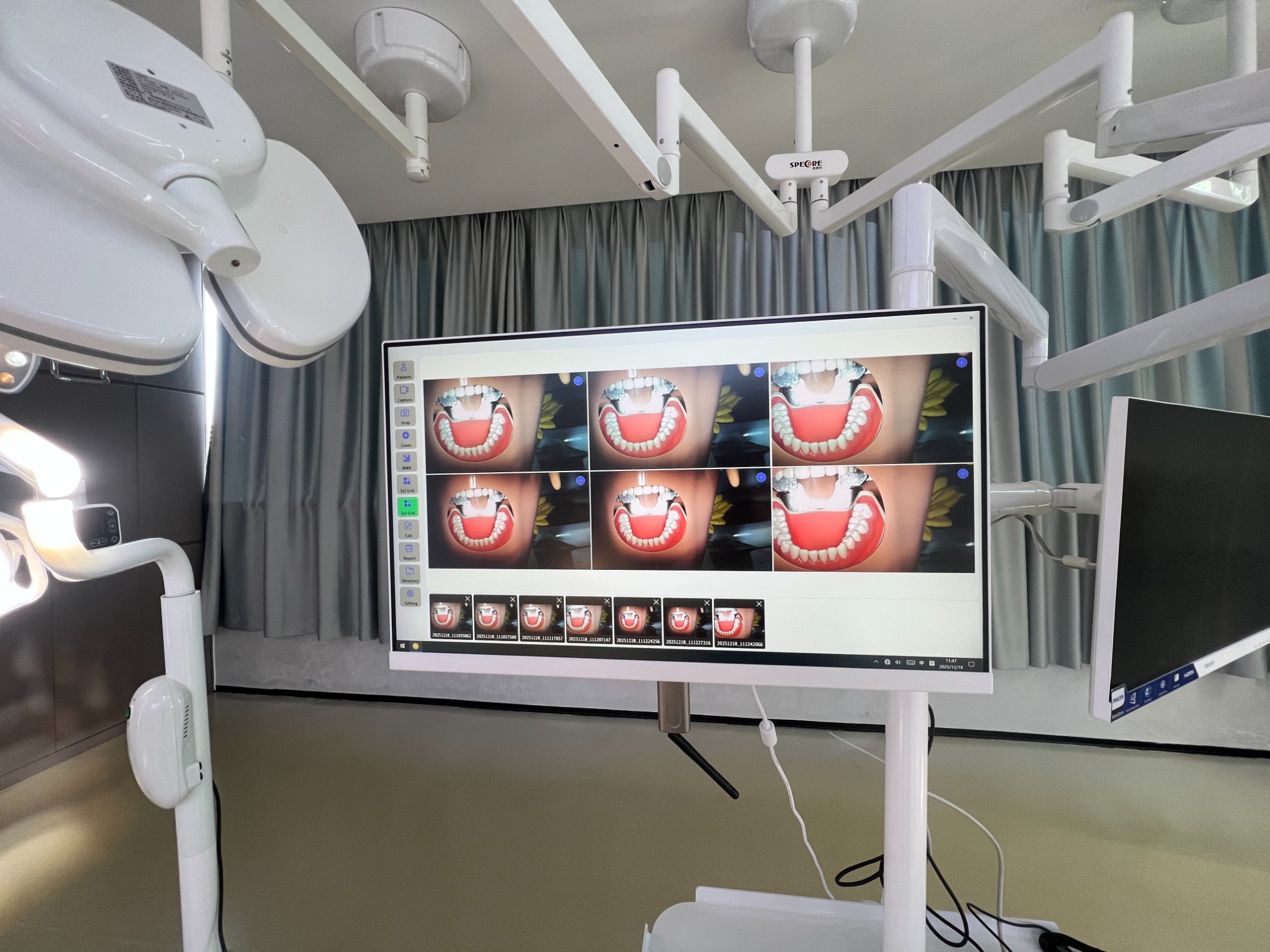 Dental Operating Lamp With Video Camera