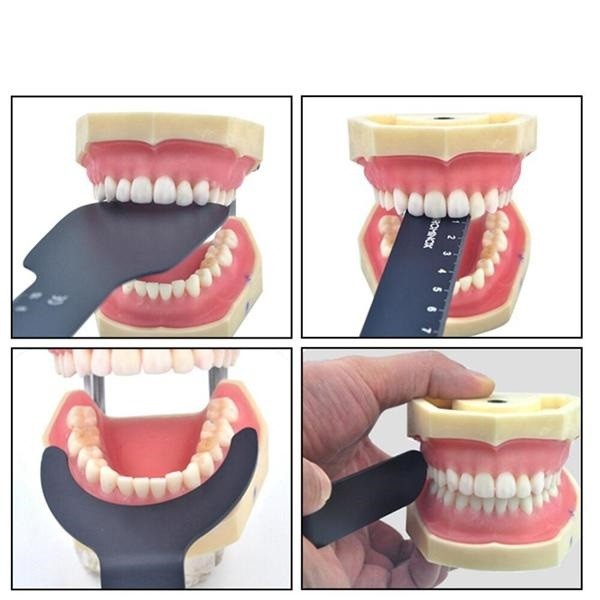 Dental Orthodontic Photo Contrast