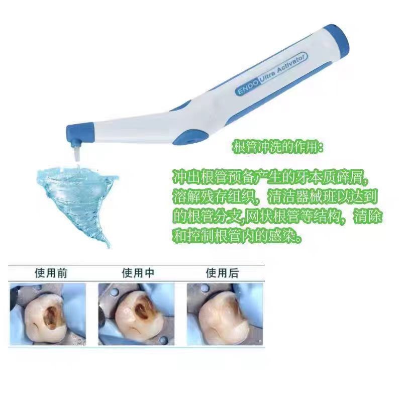 Endodontic Ultra Activator
