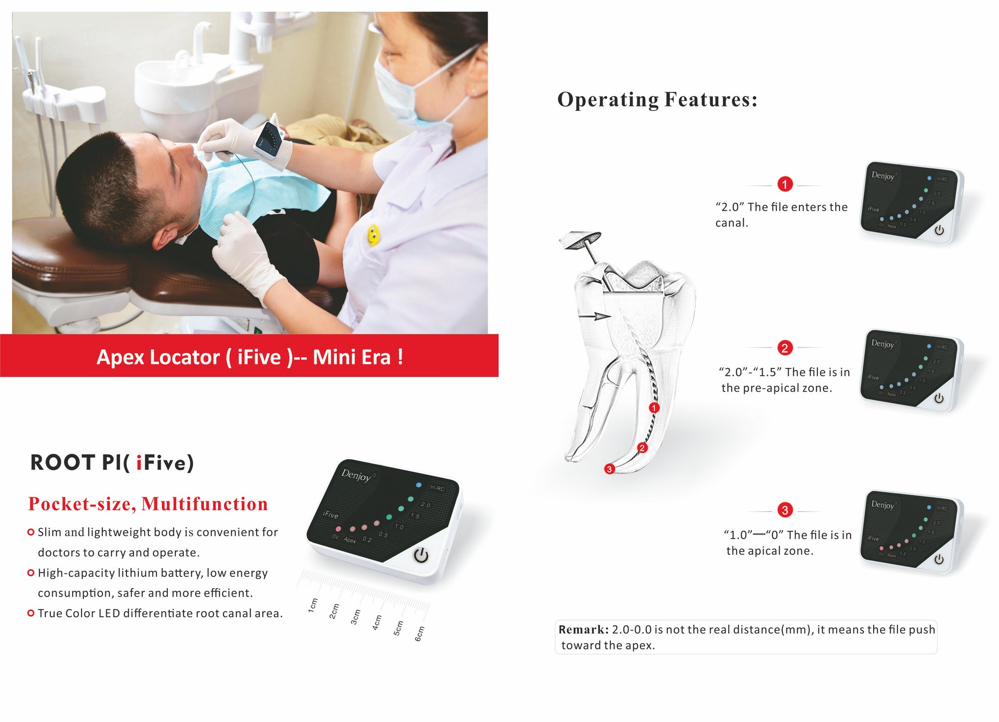 IFIVE Apex Locator