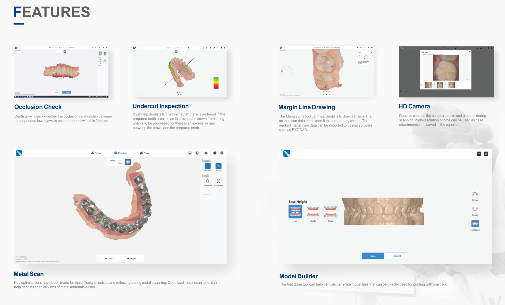 KS-SC33 3D Intra Oral Scanner