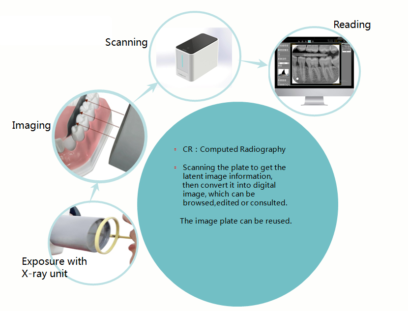 KS-XR531 X-ray Film Scanner