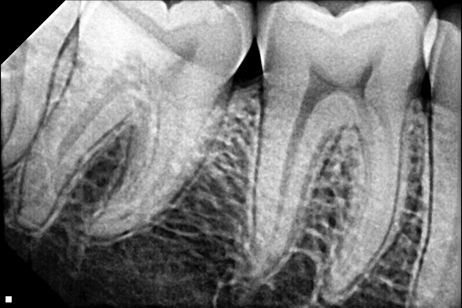 KS-XR566A X-ray sensor