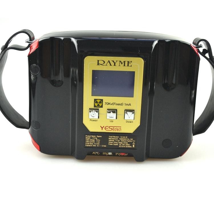 Rayme Portable X-ray Unit